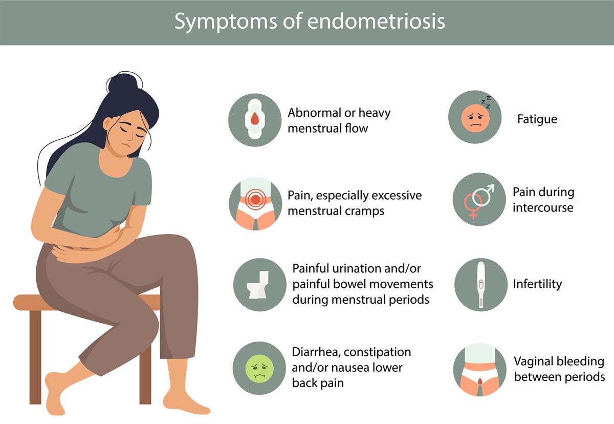 Endometrióza - príznaky.